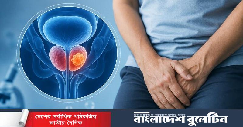 নীরব ঘাতক ‘প্রোস্টেট ক্যানসার’, যে লক্ষণ অবহেলা করলেই বিপদ!