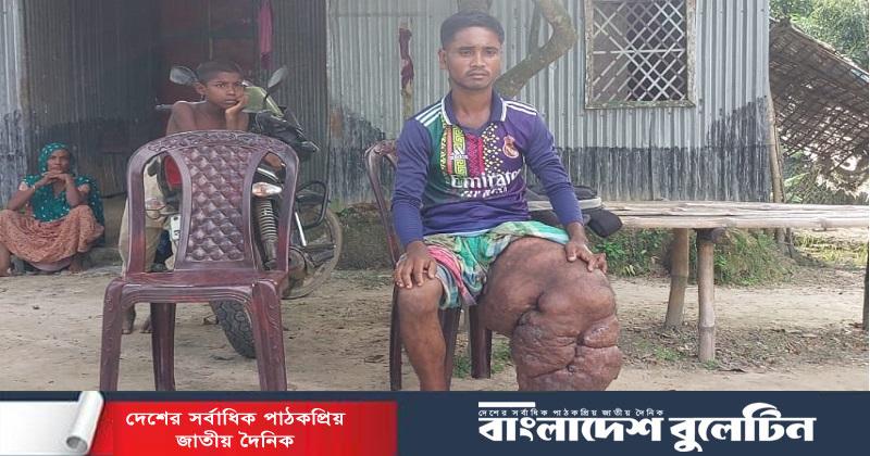 বিরল রোগে আক্রান্ত আবু বক্কর, চিকিৎসায় হাত বাড়ানোর আহ্বান ম