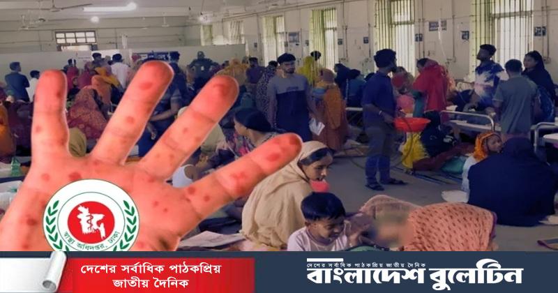 দেশে হাম ও উপসর্গে আরও ৭ মৃত্যু, মার্চ থেকে প্রাণহানি ৭৬৬